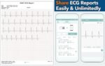 EMAY Portable ECG Monitor | Record ECG and Heart Rate | Compatible with Smartphone and PC - Image 4