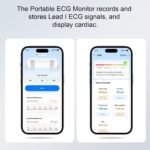 Portable ECG Monitor | Record and Store One-Lead ECG Signals | Monitor and Display Heart Rate for Home Health Care Use -White - Image 4